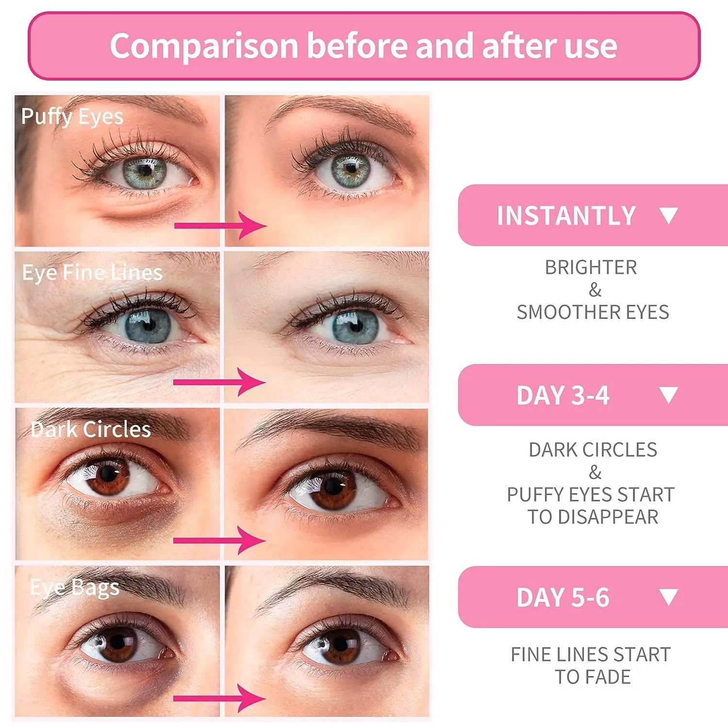 Rose Eye Mask For Dark Circles 60 Pcs